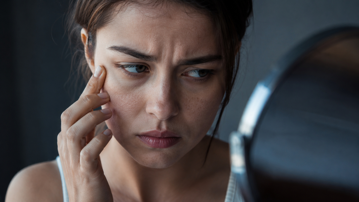 Body Dysmorphic Disorder (BDD): Signs, Risks, and Treatment