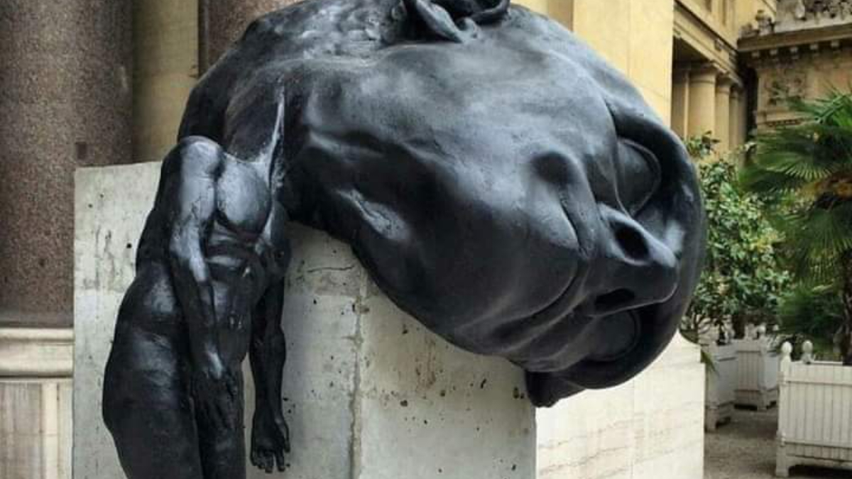 Anxiety Disorders: Understanding the Most Common Mental Health Problem Today